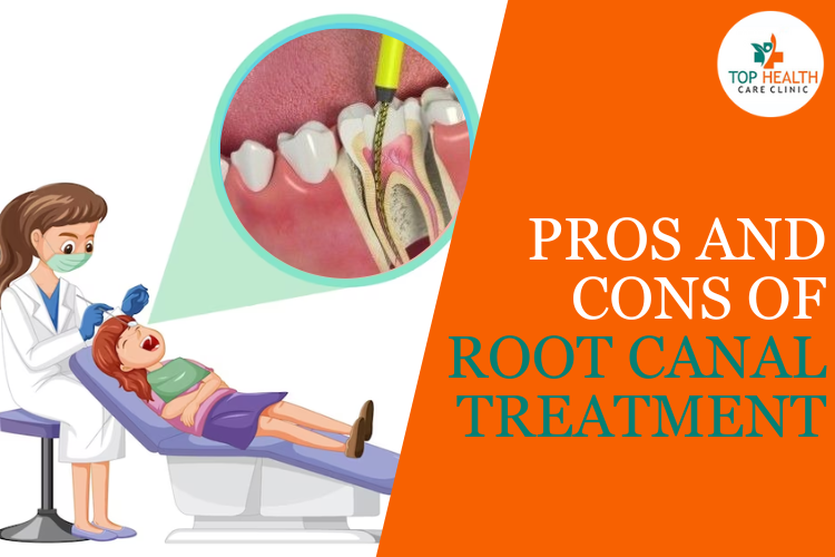 Pros And Cons Of Root Canal Treatment